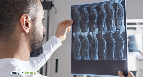 التكيف والتعايش مع تشخيص التهاب الفقار اللاصق المحوري الجديد: دليل شامل للمرضى في صنعاء