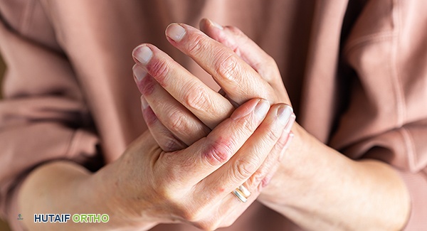 بقع الصدفية قد تؤدي إلى التهاب المفاصل الصدفي