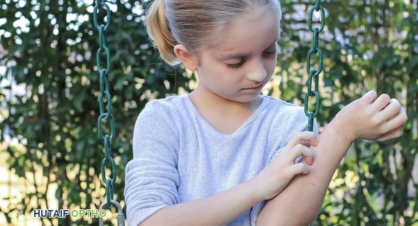 التهاب المفاصل اليفعي وأعراضه الجلدية المتنوعة: دليل شامل للمرضى