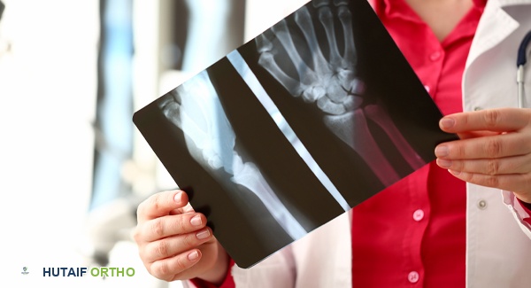 علاجات خشونة المفاصل: دليل شامل لتخفيف الألم واستعادة الحركة مع الأستاذ الدكتور محمد هطيف