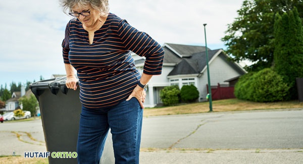 صورة بالأشعة السينية لمفصل ورك مصاب بالخشونة