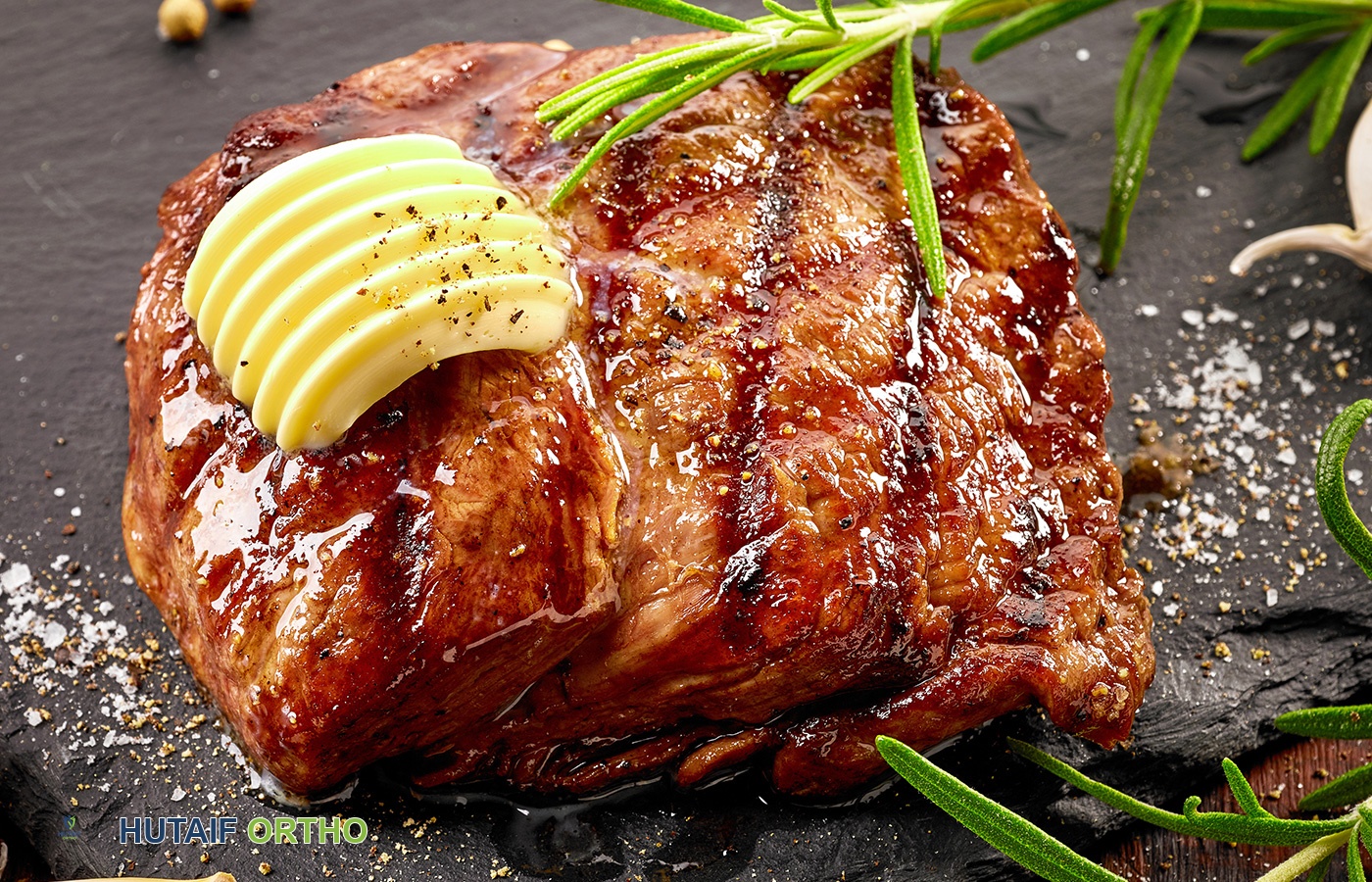 التهاب المفاصل: دليلك الشامل للتشخيص والعلاج مع الأستاذ الدكتور محمد هطيف في صنعاء