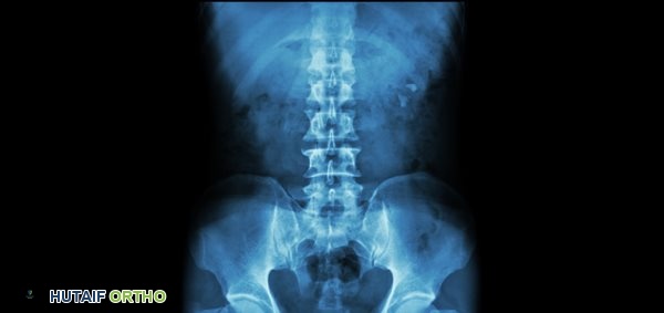 تشريح العمود الفقري