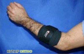 صورة طبية: مرفق التنس (التهاب اللقيمة الوحشية): دليل شامل من الأستاذ الدكتور محمد هطيف