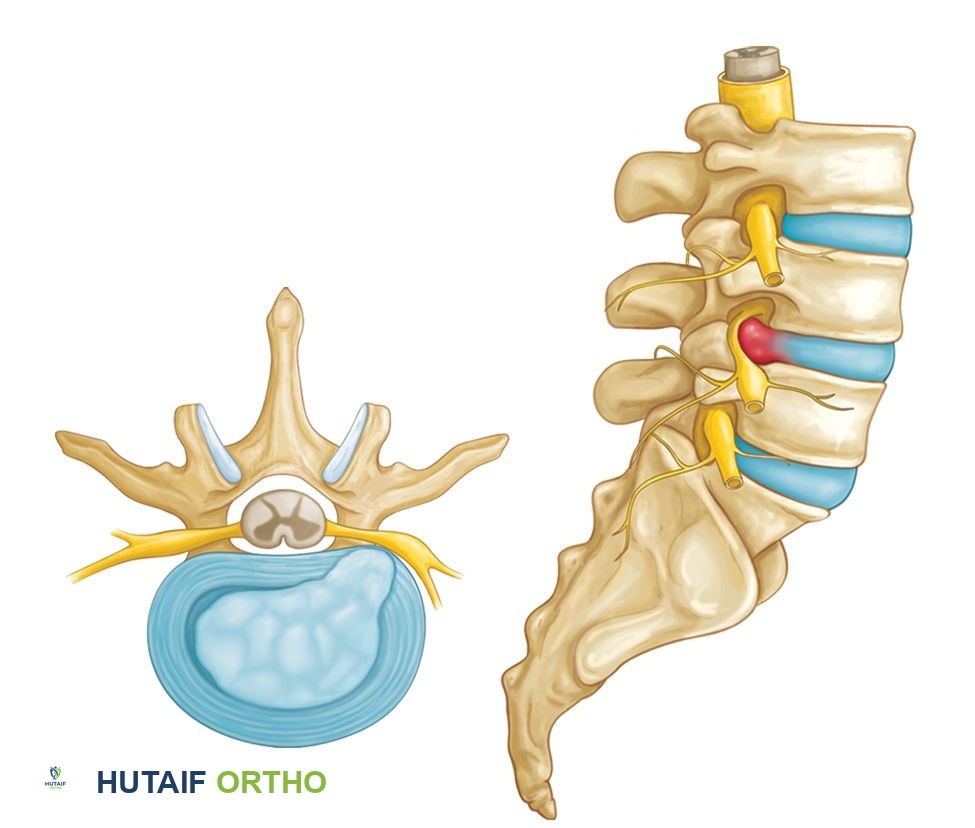 Orthopedic Surgery Board Review MCQs: AAOS Master Bank Part 13