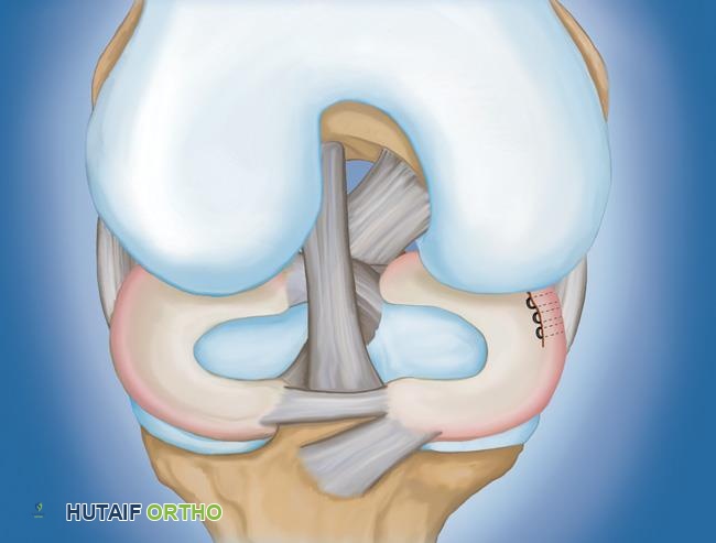 Anatomical features (b): Cervical cord: