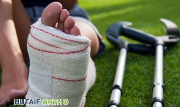 صورة توضيحية لـ كسور الساعد لدى البالغين الأسباب الأعراض العلاج والتعافي في صنعاء مع الأستاذ الدكتور محمد هطيف