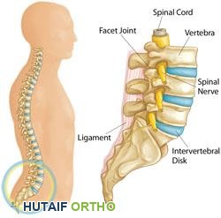 صورة توضيحية لـ عرق النسا دليل شامل للأسباب الأعراض والعلاج مع الأستاذ الدكتور محمد هطيف