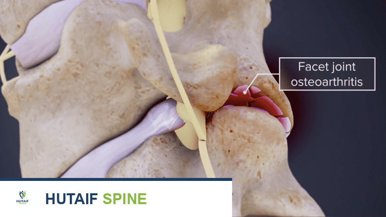 3D image of cervical spine.