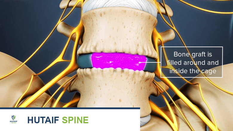 صورة توضيحية لـ جراحة استبدال المفاصل: دليل شامل لاستعادة الحركة والحياة بلا ألم مع الأستاذ الدكتور محمد هطيف في صنعاء
