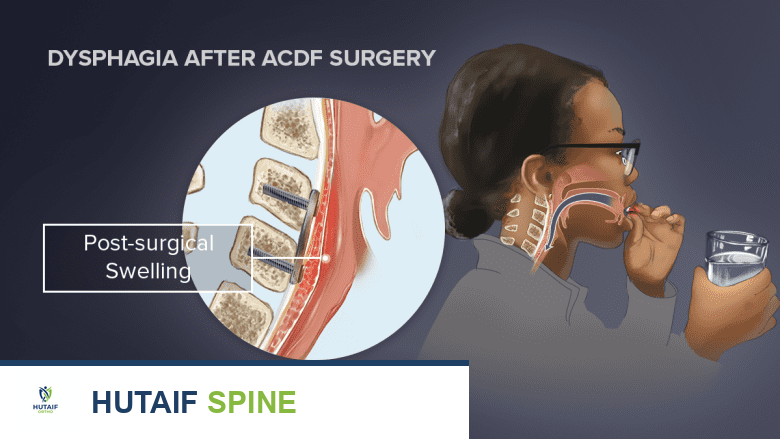 Illustration showing cross section of cervical spine with a woman holding a glass of water.