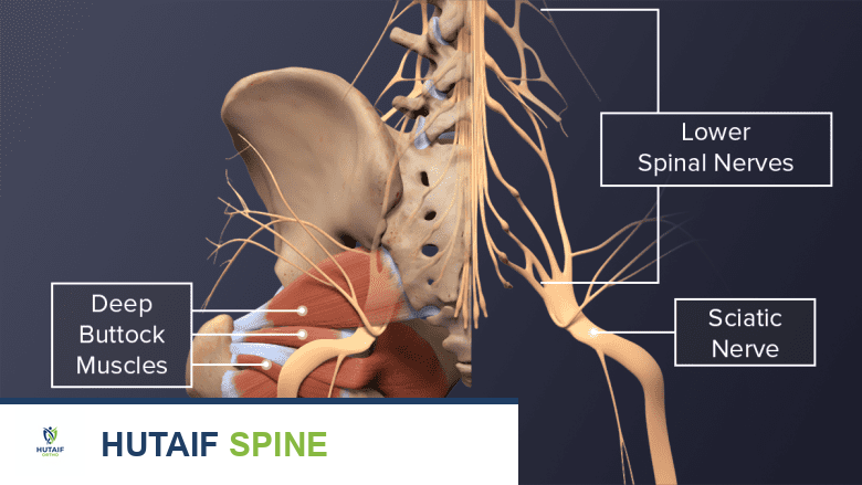 صورة توضح الأعصاب الشوكية تندمج لتشكل العصب الوركي في أسفل العمود الفقري وعضلات الأرداف العميقة.