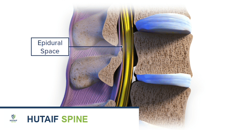 توضيح طبي: أخطر حالات الحبل الشوكي التي تسبب أعراض عرق النسا: دليل شامل من الأستاذ الدكتور محمد هطيف