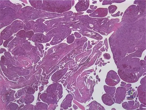 Master ABOS Orthopedic Pathology Review: Fibrous Dysplasia, PVNS, & RA | Part 19