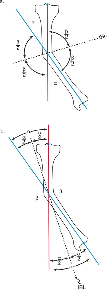 تخطيط محاور العظام في المستوى الأمامي: دليل شامل لتصحيح تشوهات الأطراف مع الأستاذ الدكتور محمد هطيف