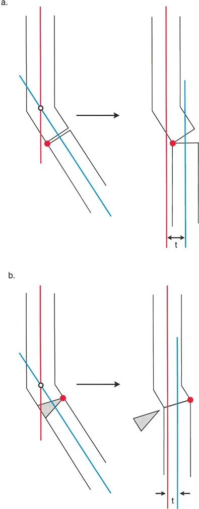 قطع العظم بالي: حلول دقيقة لتصحيح تشوهات الأطراف واستعادة استقامتها