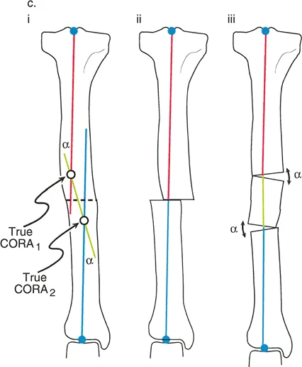 صورة طبية: تقويم تشوهات الأطراف السفلية بدقة متناهية: دليلك الشامل لمبادئ بالي المتقدمة ومركز دوران الانحراف (CORA)