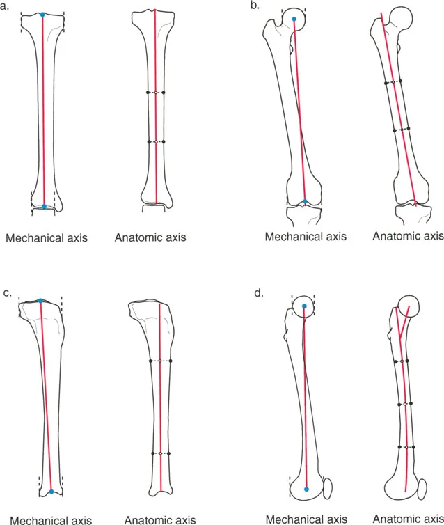 مقارنة المحاور الميكانيكية والتشريحية في عظم الساق والفخذ. لاحظ كيف أن المحاور الميكانيكية والتشريحية لعظم الساق متوازية تقريبًا ومتطابقة، بينما تتباعد بشكل كبير في عظم الفخذ.