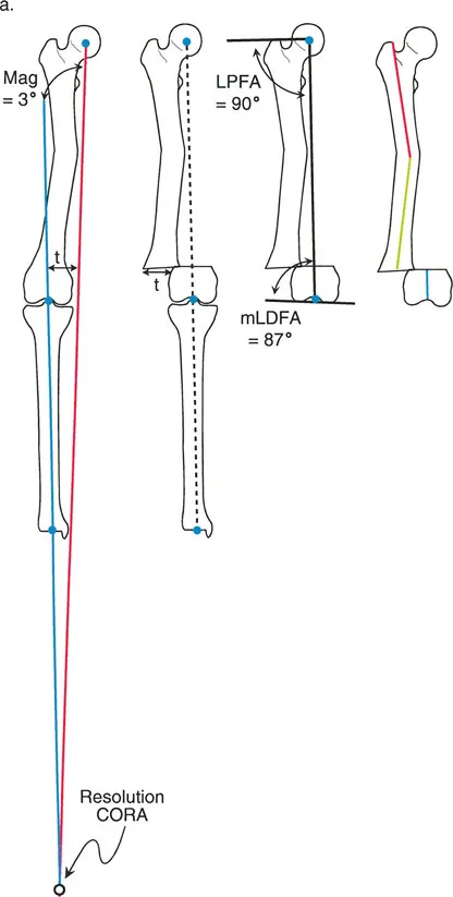 إتقان إعادة المحاذاة في المستوى الأمامي: الدليل الشامل لمفاهيم قطع العظم ومبادئ بالي المتقدمة في اليمن