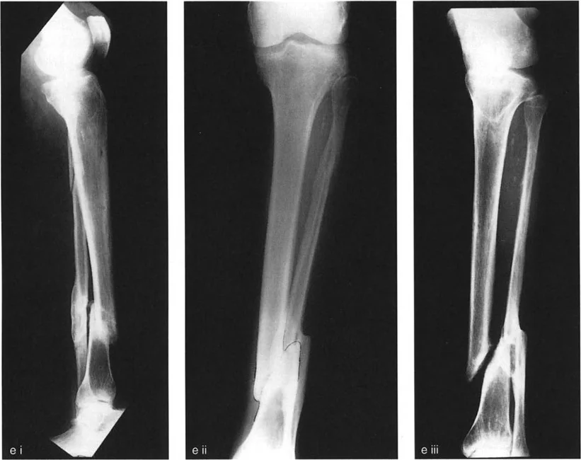 وصف طبي دقيق للمريض