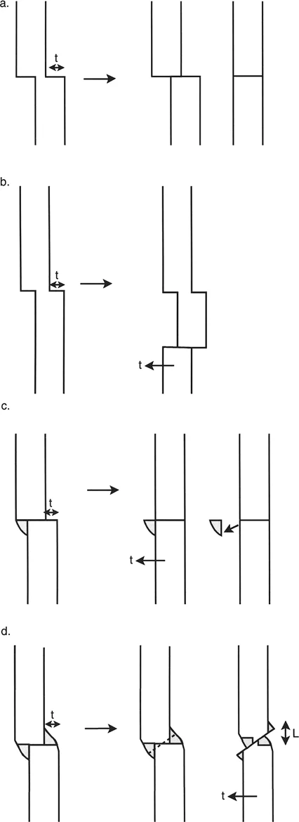 تشوهات الانزياح والانحراف-الانزياح في العظام: دليل شامل للمرضى مع الأستاذ الدكتور محمد هطيف