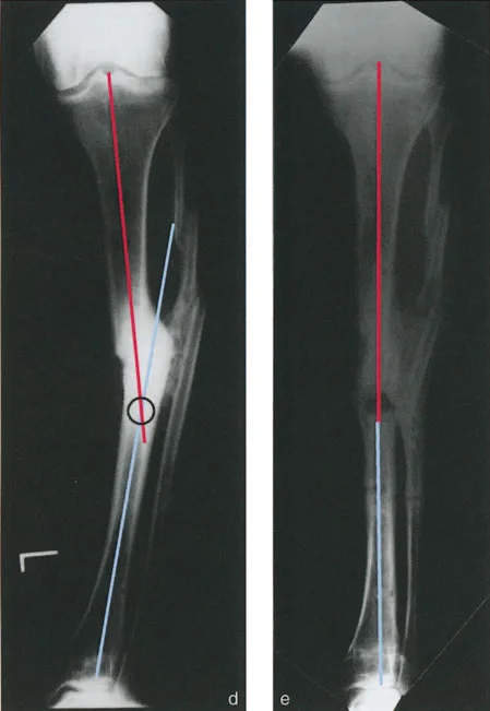 وصف طبي دقيق للمريض