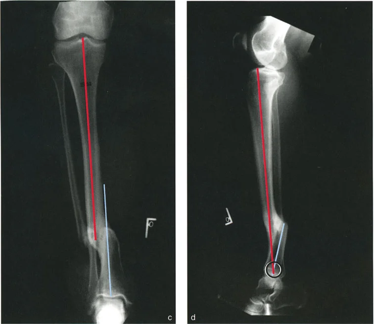 وصف طبي دقيق للمريض