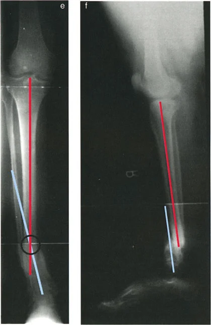 وصف طبي دقيق للمريض