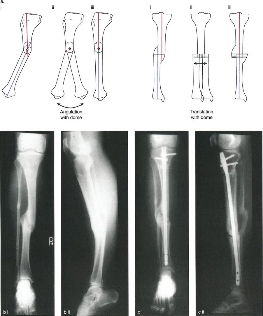 تصحيح تشوهات الأطراف: دليل شامل للمرضى مع الأستاذ الدكتور محمد هطيف