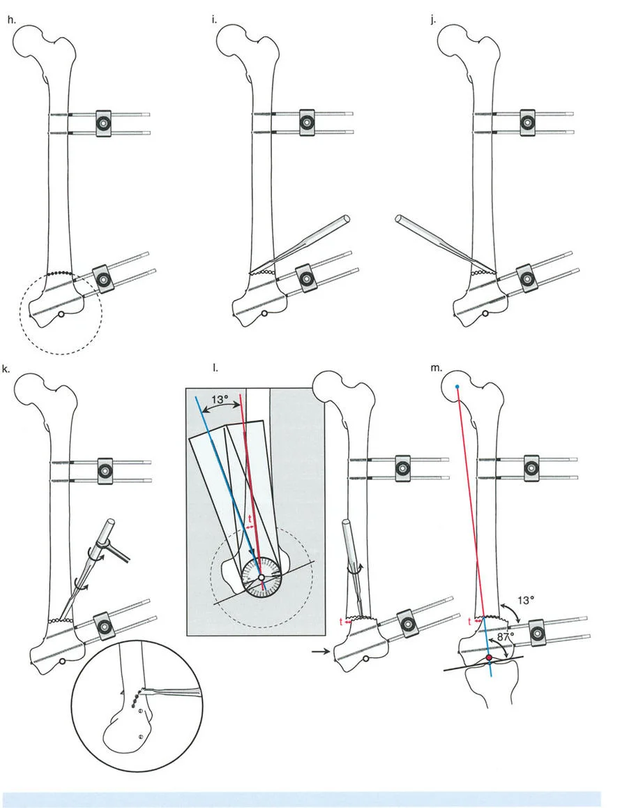 وصف طبي دقيق للمريض