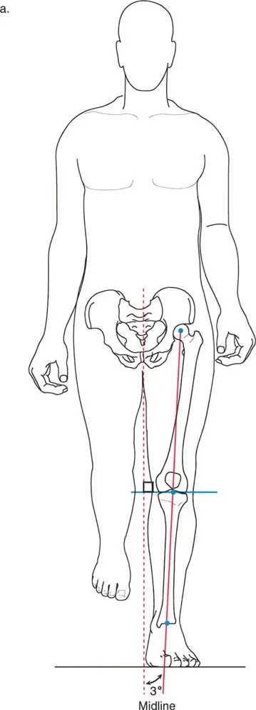 صورة طبية: فهم محاذاة الأطراف السفلية الطبيعية: دليلك الشامل لصحة المفاصل والحركة السليمة