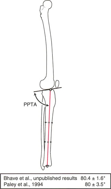 صورة توضيحية لـ فهم محاذاة الأطراف السفلية الطبيعية: دليلك الشامل لصحة المفاصل والحركة السليمة