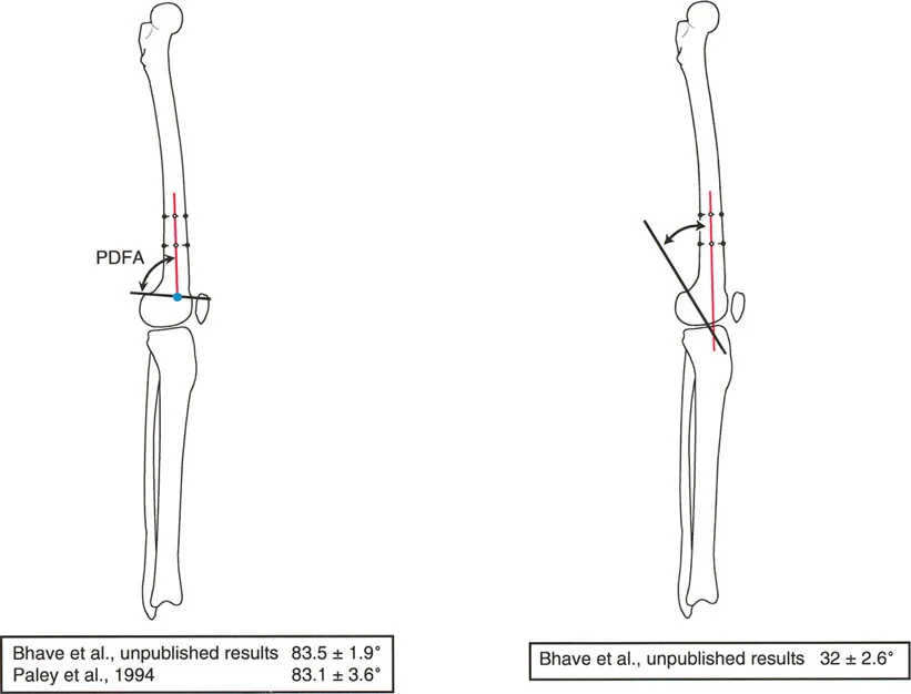 صورة طبية: فهم محاذاة الأطراف السفلية الطبيعية: دليلك الشامل لصحة المفاصل والحركة السليمة