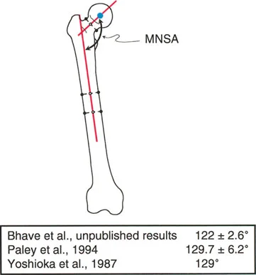 صورة توضيحية لـ فهم محاذاة الأطراف السفلية الطبيعية: دليلك الشامل لصحة المفاصل والحركة السليمة