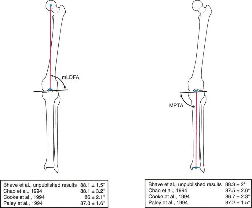 صورة توضيحية لـ فهم محاذاة الأطراف السفلية الطبيعية: دليلك الشامل لصحة المفاصل والحركة السليمة
