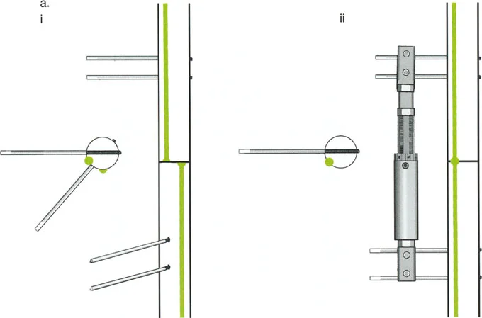 صورة طبية: تصحيح تشوهات العظام بتقنيات بالي المتقدمة الدليل الشامل للمرضى مع الأستاذ الدكتور محمد هطيف