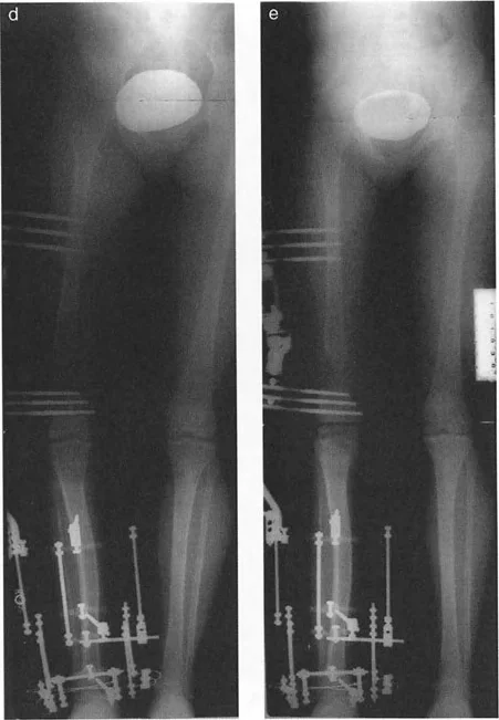 صورة توضيحية لقاعدة قطع العظم 2