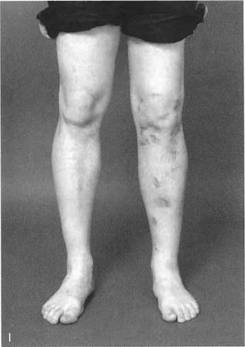 صورة طبية: السيطرة الكاملة على تشوهات العظام المعقدة: تصحيح دقيق بستة محاور مع الأستاذ الدكتور محمد هطيف