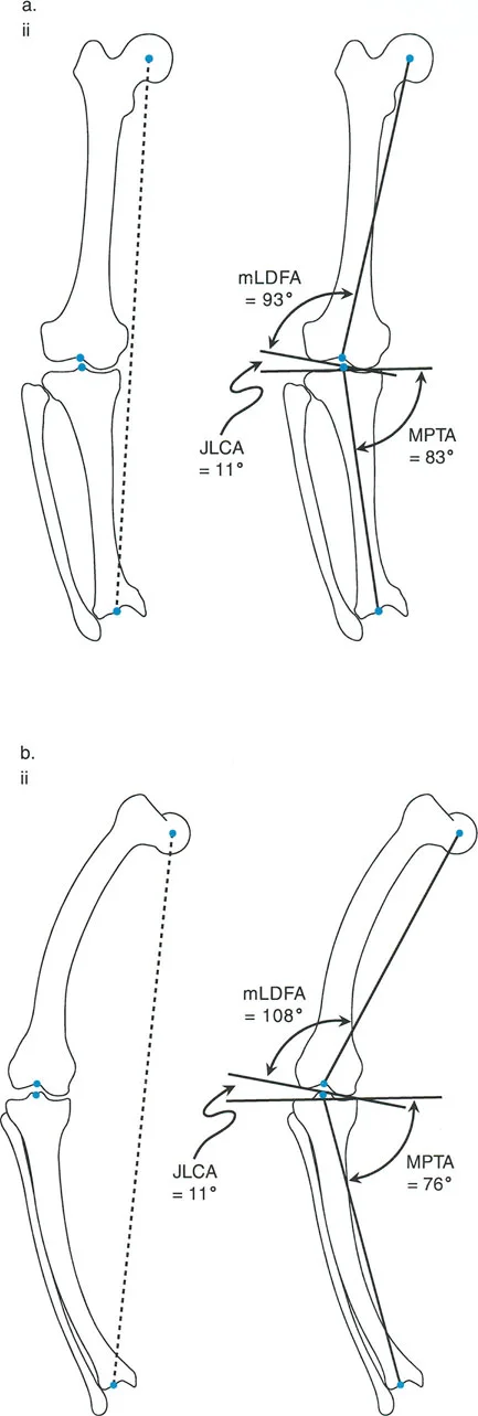 صورة طبية: تقويم تشوهات الأطراف السفلية واختلال المحاذاة: مبادئ بالي وخبرة الأستاذ الدكتور محمد هطيف