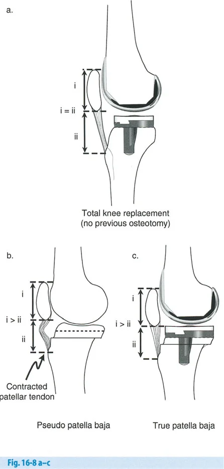 وصف طبي دقيق للمريض
