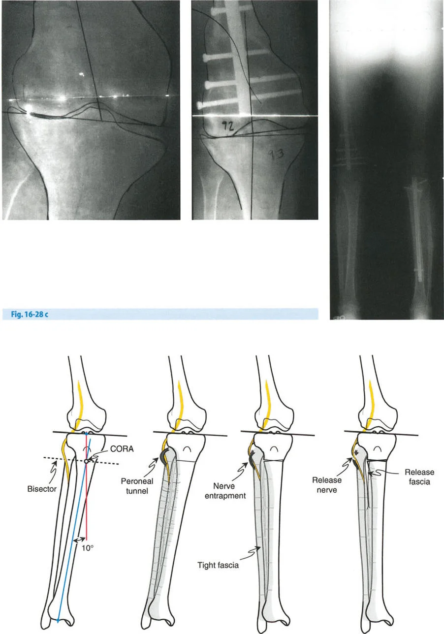 وصف طبي دقيق للمريض