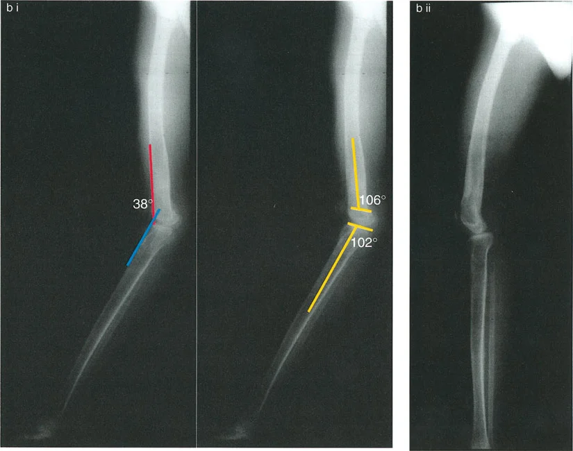 وصف طبي دقيق للمريض