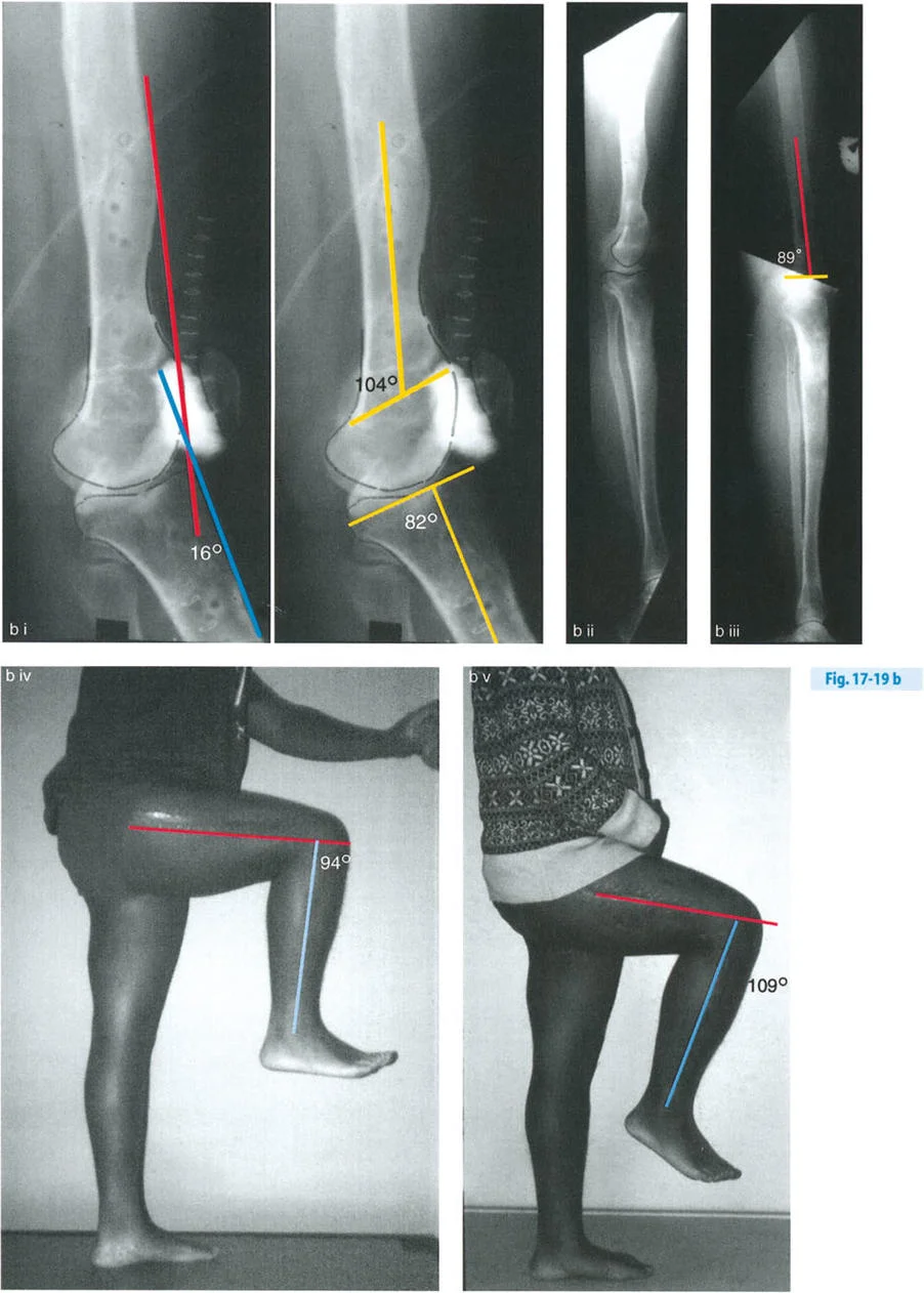 وصف طبي دقيق للمريض