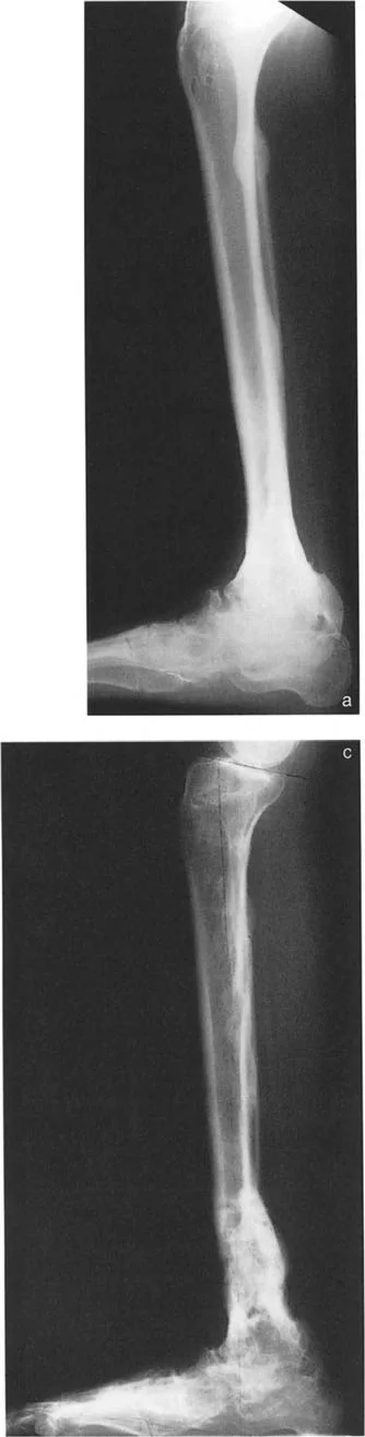 صورة طبية: الاستاذ الدكتور محمد هطيف: دليل شامل لتشوهات قصبة الساق البعيدة والكاحل في صنعاء