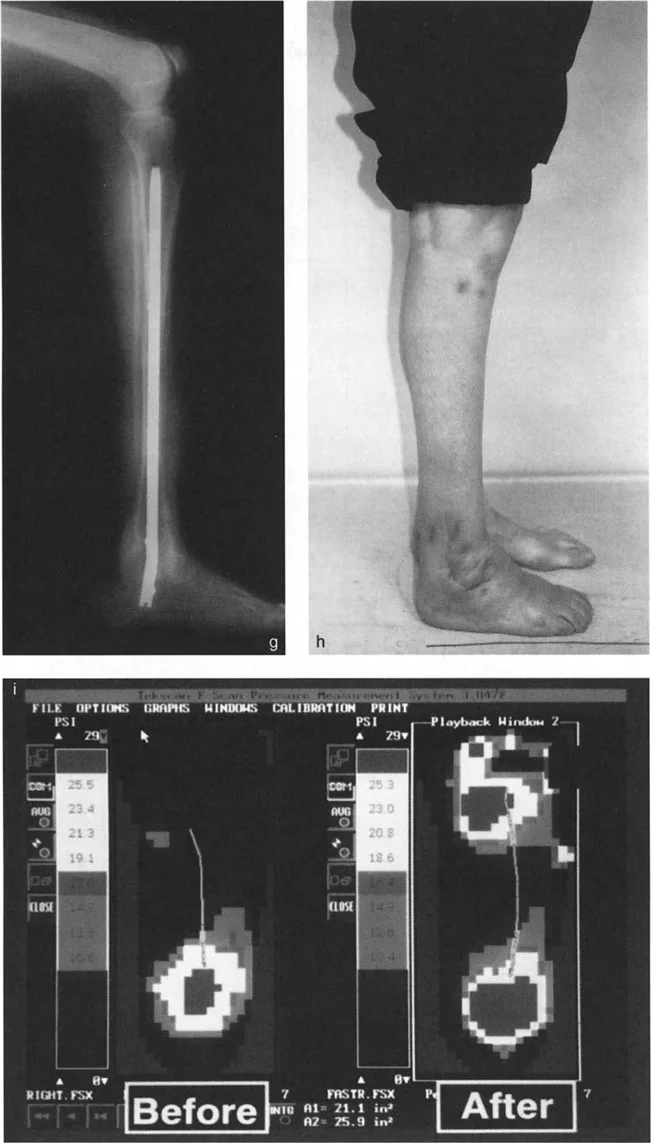 صورة طبية: الاستاذ الدكتور محمد هطيف: دليل شامل لتشوهات قصبة الساق البعيدة والكاحل في صنعاء