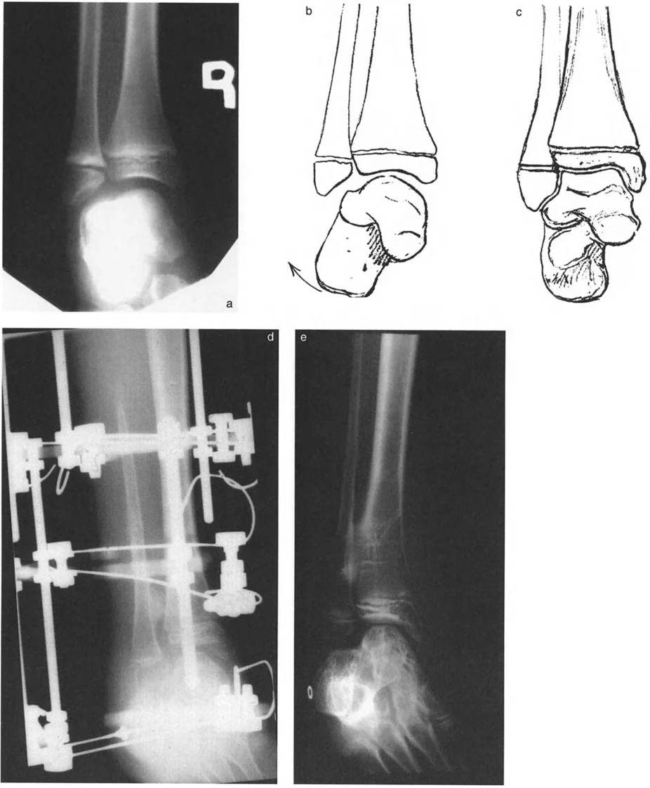 وصف طبي دقيق للمريض