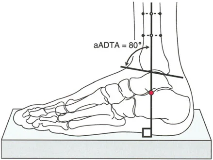 صورة طبية: الاستاذ الدكتور محمد هطيف: دليل شامل لتشوهات قصبة الساق البعيدة والكاحل في صنعاء
