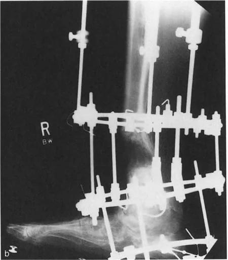 صورة توضيحية لـ الاستاذ الدكتور محمد هطيف: دليل شامل لتشوهات قصبة الساق البعيدة والكاحل في صنعاء