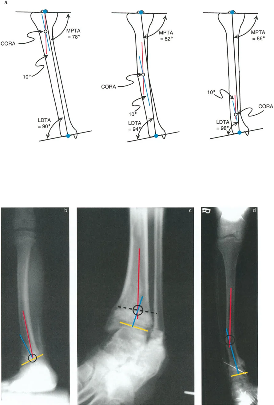 صورة طبية: الاستاذ الدكتور محمد هطيف: دليل شامل لتشوهات قصبة الساق البعيدة والكاحل في صنعاء