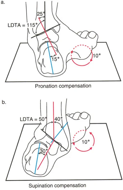 صورة طبية: الاستاذ الدكتور محمد هطيف: دليل شامل لتشوهات قصبة الساق البعيدة والكاحل في صنعاء